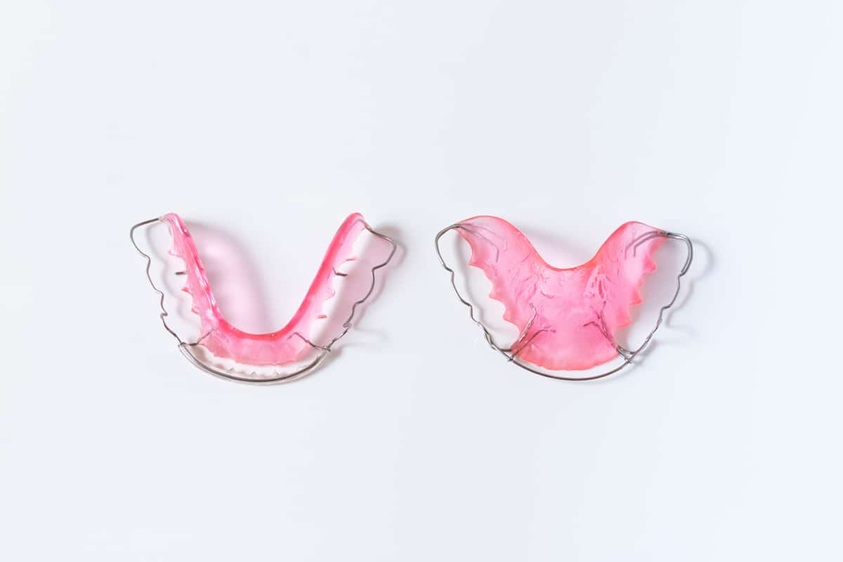 Is it possible to keep teeth straight without a retainer blog