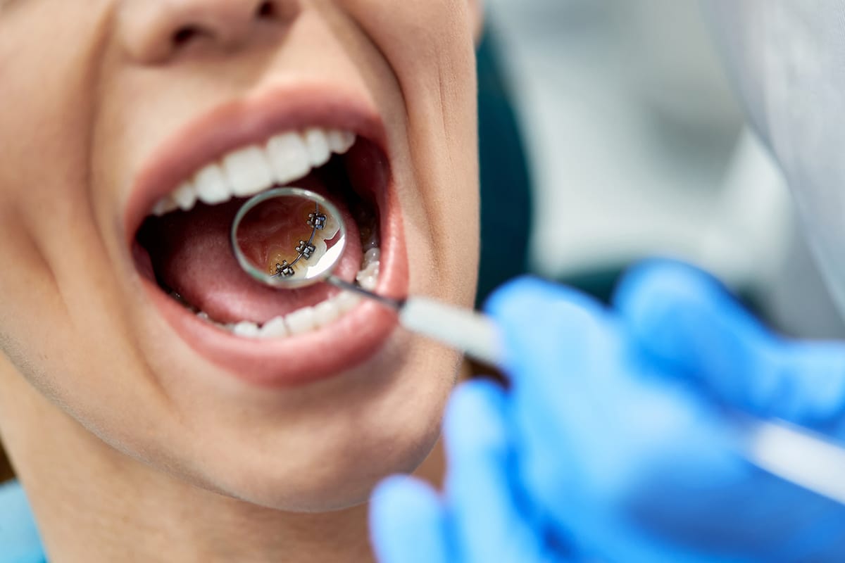 What orthodontists look for during a childs first orthodontic evaluation blog